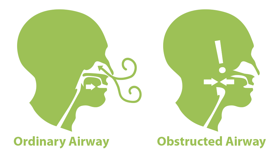 green airway graphic | Sleep Apnea Treatment | Toledo | Maumee | Ohio